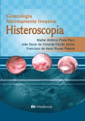 Histeroscopia